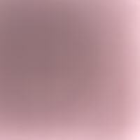 hotricc