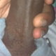 xrumn1