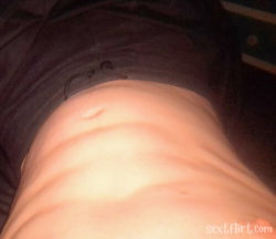 Close-up of a person's lower abdomen with visible stretch marks, wearing dark fabric, likely underwear or pants.