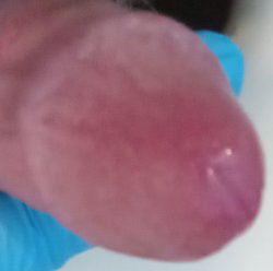 Close-up of a person's tongue sticking out with a blue object in the background.