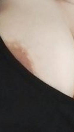Close-up of a person's bare shoulder and upper back, with a dark fabric visible below, likely a top or garment.