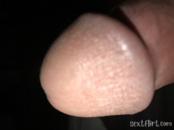 Close-up of a penis glans with visible skin texture against a dark background.