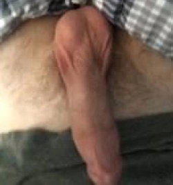 Close-up of a bare foot resting on a hairy leg, partially covered by checkered fabric.