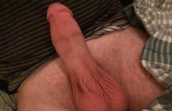 A close-up of a person's hand resting on their bare thigh.